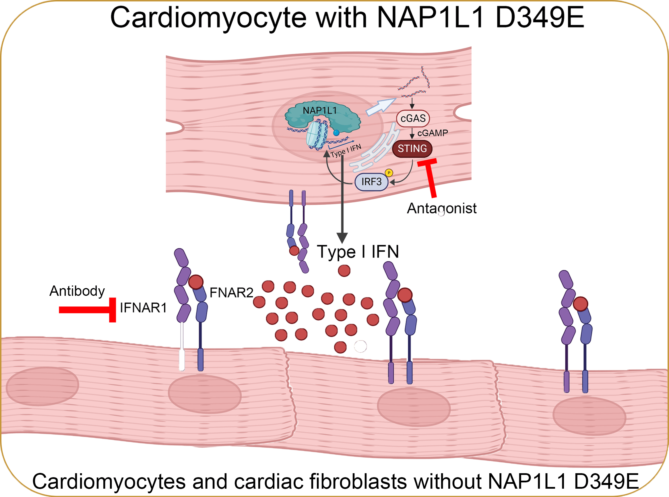 Hypertrophic Cardiomyopathy
